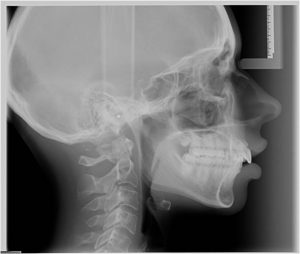 Cephalometric Imaging